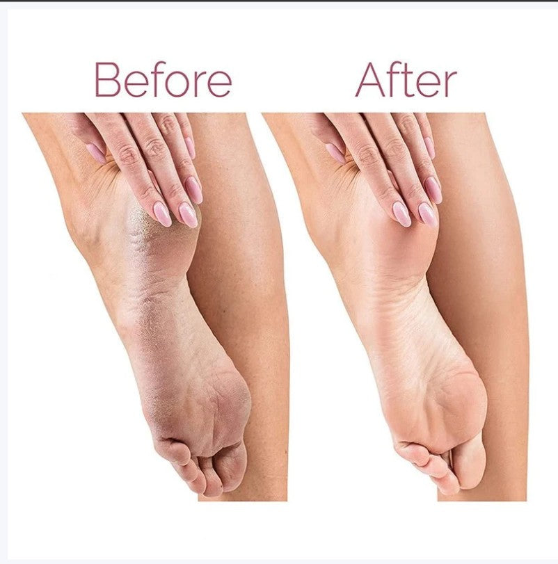 Electric Pedicure Foot File Callus Remover