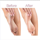 Electric Pedicure Foot File Callus Remover